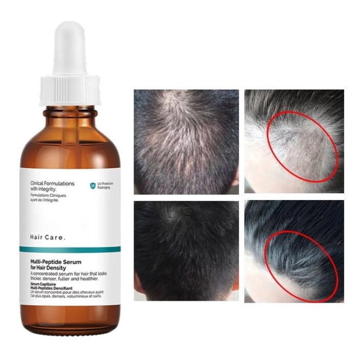 the ordinary multi peptide serum for hair density 3 scaled the ordinary multi peptide serum for hair density 3 scaled
